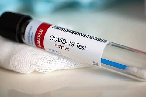 Mizoram: Two more tests COVID positive, state's tally rises to 4,184 cases