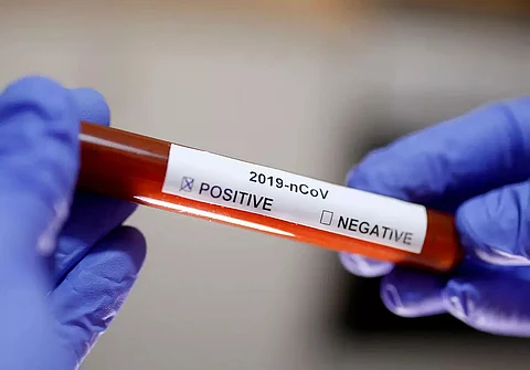 Two UAE players test positive for novel coronavirus