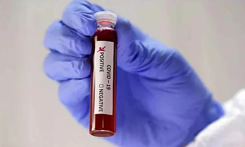 Nagaland's Mokokchung district reports its first COVID-19 positive case