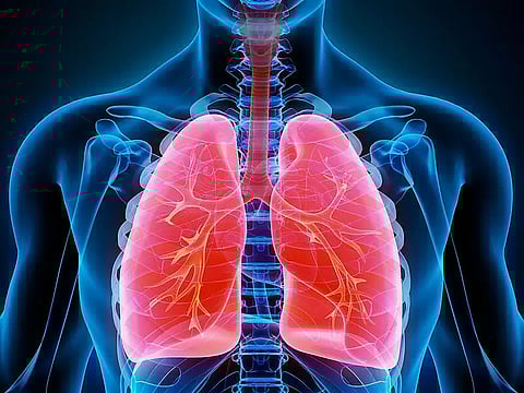 Bronchial Thermoplasty proving safe & effective for severe asthma patients in Assam