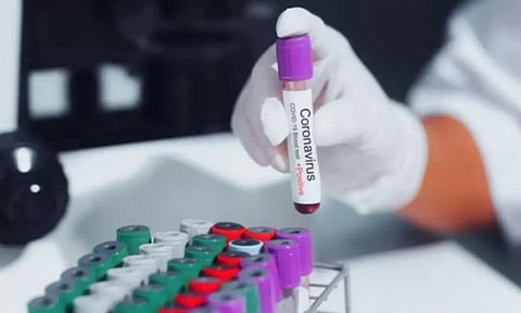 2 Bangladesh returnees test Covid-19 positive in Tripura