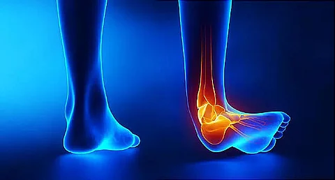 Leg Pain : What to do? Dr. K.K. Pandey