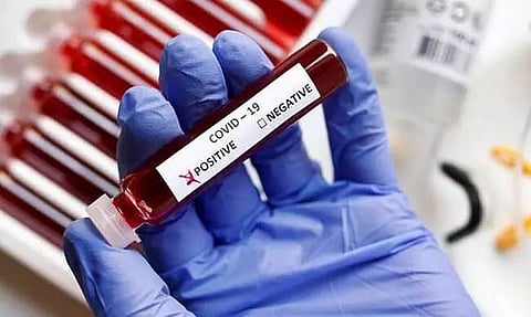 2 more test Covid-19 positive in Mizoram; total 104