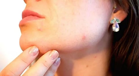 Skin problems that indicate serious underlying health issues
