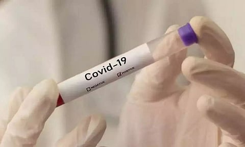 Five test positive for COVID-19 in Demow