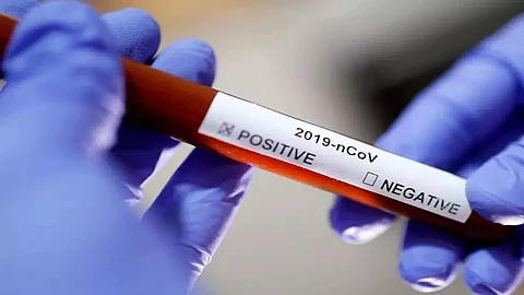 194 new COVID-19 cases in Arunachal, tally rises to 18,256