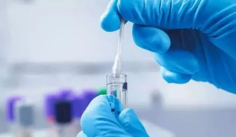 3 die of COVID in Sonitpur district, 98 new cases detected