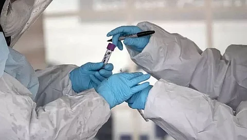 474 people infected with COVID in Dima Hasao district