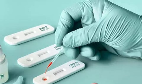 New RT-PCR Kit Developed to Detect Various Mutant Strains