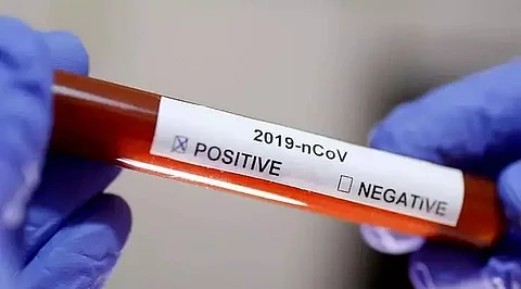 12 test COVID positive in Barpeta district jail