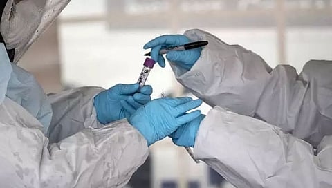 84 Die of COVID in Assam on Monday, 6,221 New Cases Detected