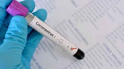 2 die of COVID in Sonitpur district, 228 new positive cases detected