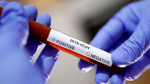 Meghalaya Records 14 COVID Deaths, 408 New Cases Registered