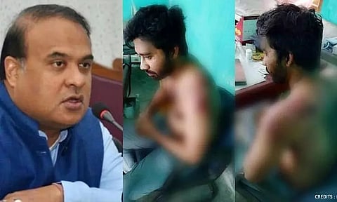 Brutal Attack on Assam Doctor, 24 Arrested, CM Condemns ''Barbaric'' Act