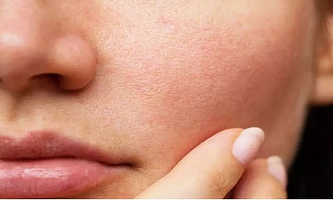 Can you really shrink your pores?