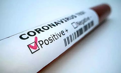 Arunachal Pradesh reports 250 fresh COVID cases
