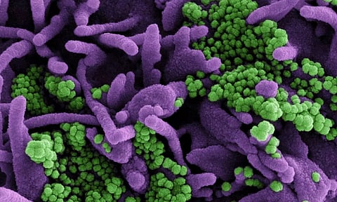 Confirmed Cases of Delta Variant of Covid-19 Found in Manipur