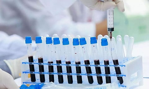 Single Blood Test 'Galleri' Can Detect 50 Types of Cancer: GRAIL, Inc