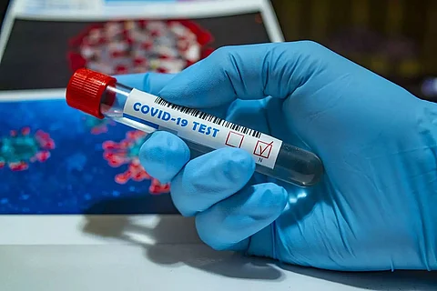 Arunachal Pradesh logs 404 fresh COVID-19 cases, three casualties