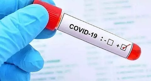 Arunachal Pradesh logs 254 new COVID cases, one casualty