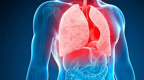 Sonitpur district NTEP initiated 'Jan Andolon in Tuberculosis'