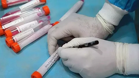 Meghalaya logs 597 new Coronavirus infections