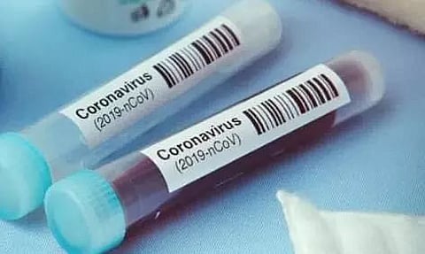 Two test COVID-19 positive in Rajabari Junior College quarantine centre