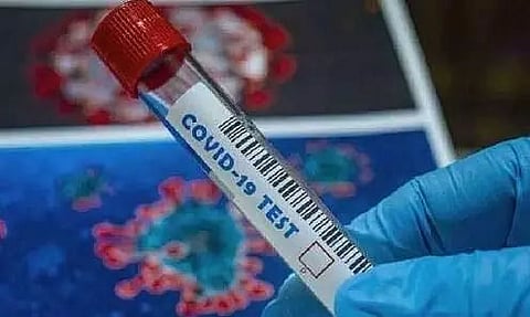 Six more dies of corona in Assam; death toll rises to 76