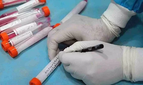 Meghalaya logs eight more Corona casualties