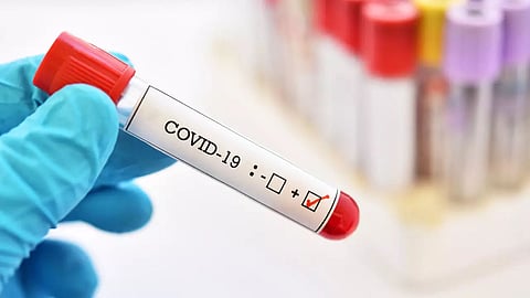Meghalaya logs 576 new COVID-19 cases