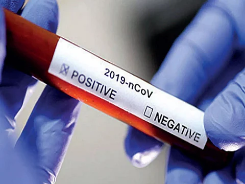 Tokyo reports more Covid positive cases