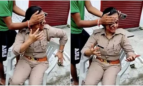 Woman Police Constable Injured After Man Harasser Attacked Her in Lucknow