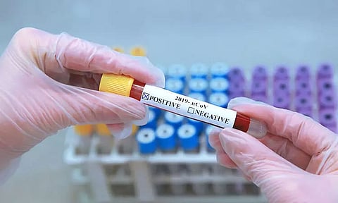 Meghalaya records one COVID fatality