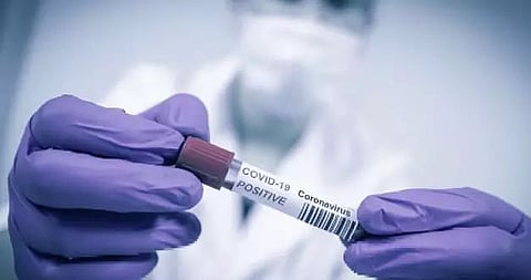 385 fresh COVID-19 cases detected in Assam, recovery rate 98.29%