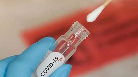 Five die of Corona, 270 new cases detected in Assam