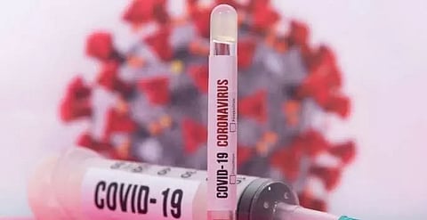 One die of Corona, 147 fresh cases detected in Assam