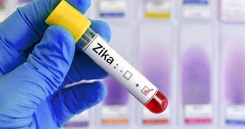 25 new Zika virus cases reported in Uttar Pradesh's Kanpur