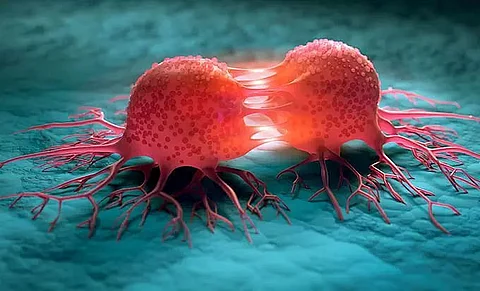 Cancer on the rise in Northeast India