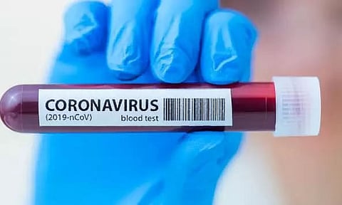 6,982 positive cases detected on a single day in Assam