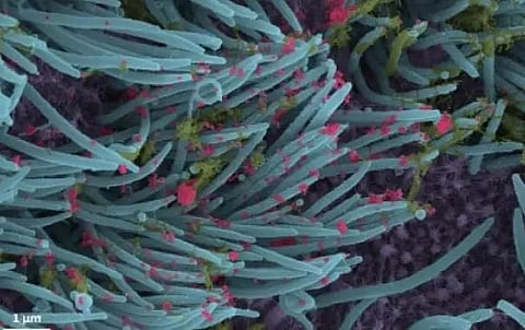 'Lethal NeoCov only 1 mutation away from infecting humans'