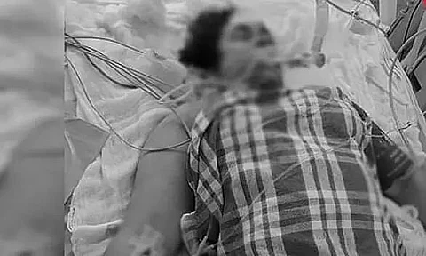 Assam: Minor Girl Shoots Herself With Father's Licensed Pistol In Dibrugarh