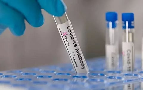 Beijing begins mass testing after a spike in Covid cases