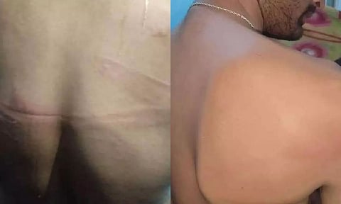 Assam: Several Injured In Violence Over Jorhat's JB College Students' Union Election