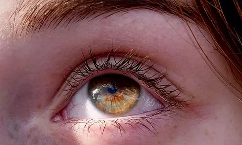 Free eye screening held at Dhubri Lions Vision Centre