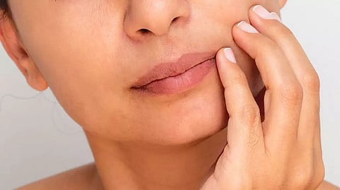 What causes flaky skin? Know Here