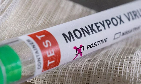 Monkeypox: WHO reports 5,322 lab-confirmed cases in 53 countries