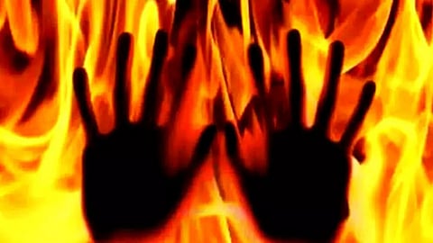Assam: Man Accused Of Murder Allegedly Burnt Alive In Nagaon District