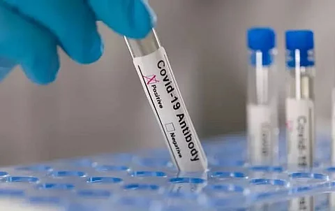 India reports 20,279 fresh Covid-19 cases, 36 deaths