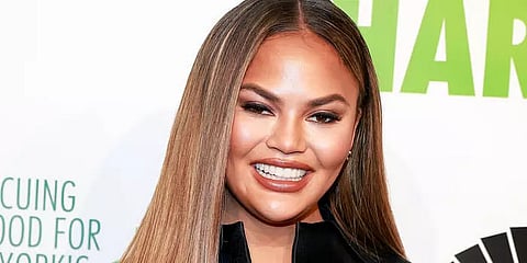 Model Chrissy Teigen trolls Donald Trump with first sonogram of her baby