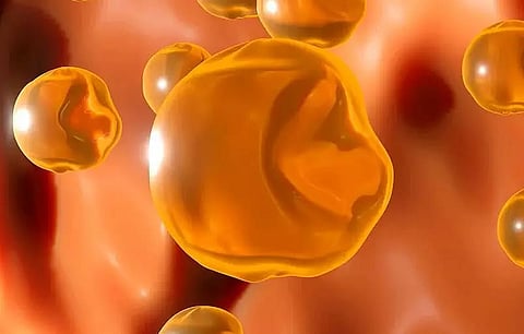 Can cholesterol levels raise risks to acute Covid?